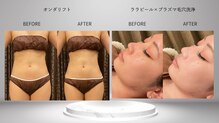 アクトベレッザ(Act BELLEZZA)