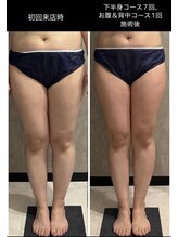 トータルビューティー ミミ(Total Beauty mimi)/太もも集中施術！