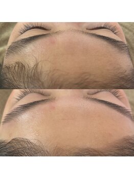 スイ 四条烏丸(SUI)/おでこの毛