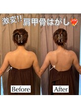 アイミーボーテ(Aime beaute)/大人気上半身DETOX！！