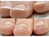 ネイルが出来ない人【深爪・形が悪い】ネイルケアだけで爪を再生!