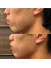 フェリーバ 流山店(FELIVA)/薄い方でもお気軽にご相談