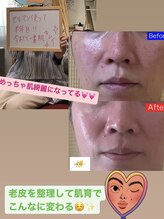 エナジーサロン アカリ(燿)/セルマンフルメニュー2