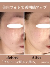 ウィッシュ 与野(Wish)/美白フォト×毛穴洗浄