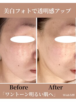 ウィッシュ 与野(Wish)/美白フォト×毛穴洗浄