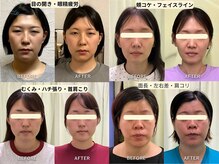 整音(totonone)の雰囲気（小顔/口ゴボ/Eライン/リンパ/二重アゴ/エラ張り/左右差/ハチ張り）
