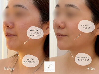 リルビューティーラボ(LILU BEAUTY LAB)の写真