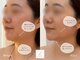 リルビューティーラボ(LILU BEAUTY LAB)の写真