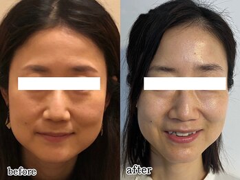 巡りサロン結希(ゆき)/半年の結果