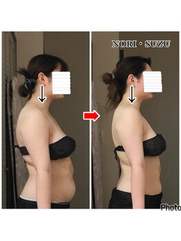 ノリスズ(NORI SUZU)/スマホ首/猫背/前肩/反り腰改善