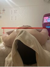ウツク(utuku)/左側をマシンで筋膜リリース　