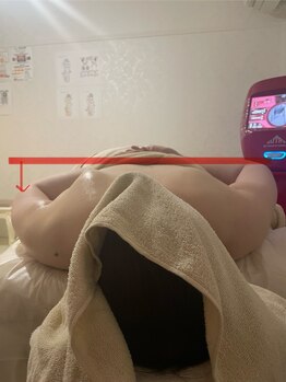 ウツク(utuku)/左側をマシンで筋膜リリース　