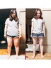 ☆10名限定☆ダイエットモニター募集（電気鍼タイプ）11000→5500円数要相談