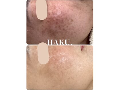 ハク(HAKU)の写真