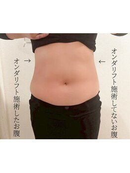 ディア(Deer)/韓国マイクロウェーブ