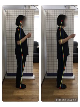 ボディメイク整体院 横浜駅西口店(BodyMake)/施術風景-首がつらい30代女性-