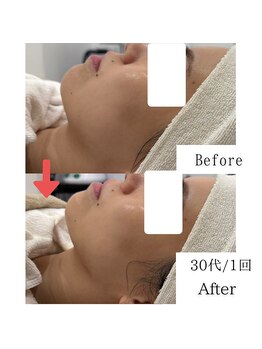 グラシア(gracia)/シミ・毛穴ケア専門店gracia