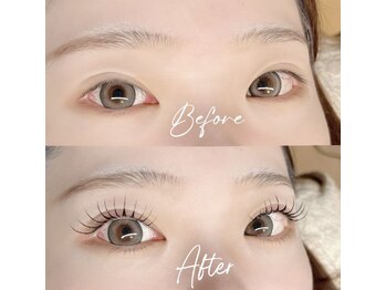 イル(ile)/アンドヘルシー/フラット120本