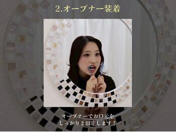 ホワイトニングサロン ホワイト 天童店(WHITE)/2.オープナー装着