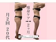 デマントイド 倉敷(Demantoide&Co)/オールハンド痩身