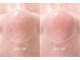 ノン(non.)の写真/【通いやすい価格×完全個室】毛穴・くすみ・肌悩みに寄り添うプライベートエステ♪