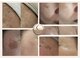 グレイス モリヤ(Grace Moriya)の写真