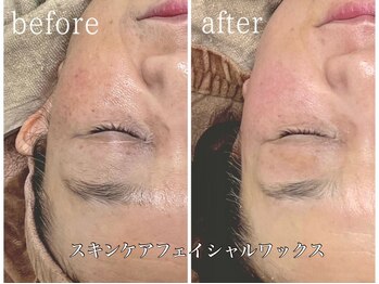 アンドナップ(nap)/スキンケアフェイシャルワックス