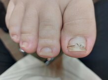 爪切り屋 足楽/オルトグリップシュパンゲ