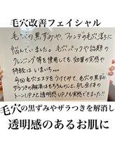 ルネッタ(Lunetta)/