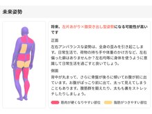 かがりの整骨院 東近江八日市院/AIによる姿勢分析