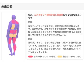 かがりの整骨院 東近江八日市院/AIによる姿勢分析