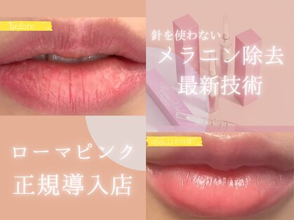 クライム(CLIMB)の写真