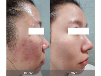 エングロー 錦糸町店(Englow)/