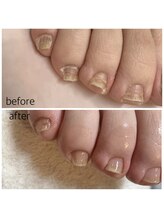 リネイル 長浜(Re-na-iL)/ネイルケア＆スパ¥7000