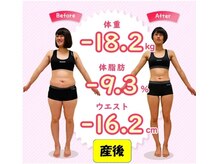 脱毛 アンド メイクボディ かんばやし