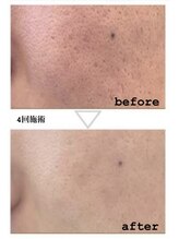 レンリー(Renry)/水光肌目指すならコレ！！