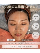 スハダラボ 恵比寿本店(Suhada LABO)/-チタニウムリフト-