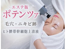 アンノン(Annon)