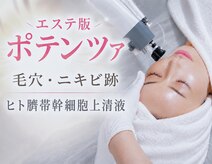アンノン(Annon)