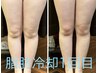 脂肪冷却