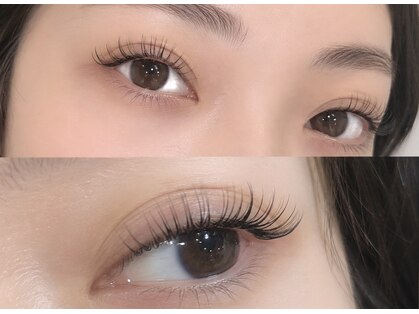 ルネル(Lunelle)の写真