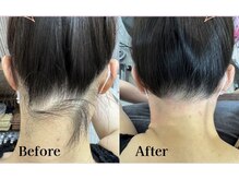 サクラ(SAKURA)の雰囲気（ワックス脱毛メニューも豊富です。ご希望を最優先する信頼脱毛☆）
