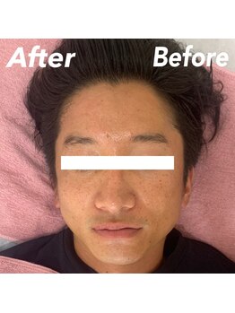 ラ フルール(La Fleur)/エアバリ