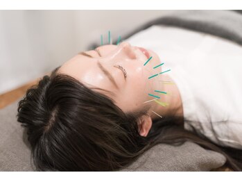 コガオ レンネ(Lenne)/小顔になれる美容鍼♪