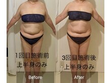 ウツク(utuku)/上半身BODYメイク　長岡/痩身
