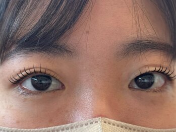 シェノン(Chainon)の写真/<ダブルアイリフト導入店>重め瞼,一重,眼精疲労など悩む女性を救う新技法!アイストレッチでお悩みを解決★