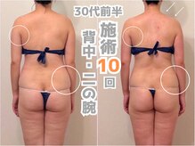 ティセラ(TISERA.)/