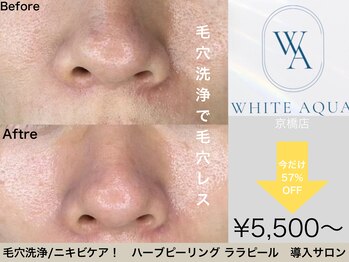 ホワイトアクア 京橋店(WHITE AQUA)