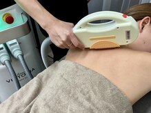 バタフライ 津田沼店(Butterfly)/お背中の脱毛