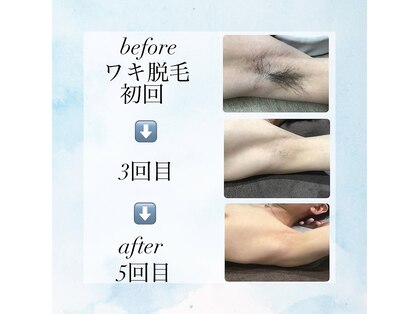 ノーブル(NOBLE)の写真